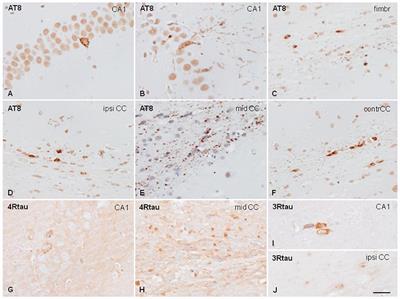 Corrigendum: Capacity for Seeding and Spreading of Argyrophilic Grain Disease in a Wild-Type Murine Model; Comparisons With Primary Age-Related Tauopathy